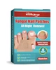 Коригувальні пластир-наклейки для врослих нігтів Nail Patches в упаковці 16 штук R9360 - зображення 1