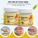 Крем від псоріазу, екземи, атопічного дерматиту Sumifun Psoriasis Cream, 20 г - изображение 3