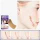 Силиконовый пластырь от шрамов и рубцов EELHOE Silicone Scar Sheet 8 штук - изображение 4