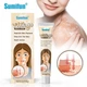 Зволожуючий крем для освітлення білих плям від вітіліго Vitiligo Removal Cream, 20г - зображення 2