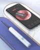 Эндоскоп бороскоп Бездротова камера Wi-Fi глазок наблюдения ушной отоскоп для чистки ушей - изображение 5