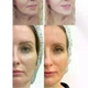 Микротоковый RF массажер для лица MEDICA+ Skin Lifting 7.0 Pink – EMS, LED, 6 режимов, 10000 вибраций/мин, 1000 мАч - изображение 9