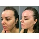 Мікрострумовий ліфтинг MEDICA+ Skin Lifting 5.0, світлодіодна терапія, масаж гуаша, біле золото, для домашнього догляду за обличчям - зображення 8