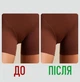 Камуфлирующая силиконовая вставка для женского нижнего белья Y-shaped самоклеящийся корректирующий патч / ластовица / накладка для бикини и трусов, прозрачная (110029926) - изображение 5