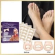Набор для коррекции врастающих ногтей Elastic Toenail Correction Sticker 50 шт Бежевый (2104618421) - изображение 2