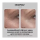 Антивозрастной крем лифтинг для кожи вокруг глаз Medi-Peel Peptide 9 Volume Lif-Tox Eye Cream, 20 мл - изображение 2
