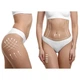 Кавітація "LIPOZERO G150", GLOBUS, Італія,42 програми - зображення 2