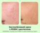 Успокаивающий крем для лица MEDIPEEL Young Cica PDRN Trouble Soothing Cream 80 мл (8809941824315) - изображение 4
