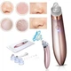 Вакуумный аппарат для чистки пор лица Beauty XN-8030 3 уровня всасывания 5 насадок - изображение 3
