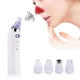 Вакуумный аппарат для чистки пор Derma Suction White 100 3 режима работы 4 насадки - изображение 1
