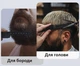 Гребінець похідний складаний 3в1 - зображення 6