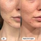 Гидроколлоидные пластыри от прыщей Hero Cosmetics Mighty Patch Original 36 шт - изображение 5