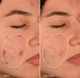 Гель-пробиотик для борьбы с акне Dermalogica Breakout biotic moisturizer 50 мл (666151115071) - изображение 3