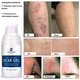 Силиконовый гель против рубцов и растяжек MURASAKI BEAUTY 100% Silicone Scar Gel 30 г - изображение 3