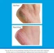 Крем для ног O’Keeffe’s Healthy Feet Intensive Pflege 80 мл от трещин, сухости и огрубевшей кожи стоп - изображение 5