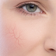 Krem do twarzy Dermedic Redness Calm na trądzik różowaty 40 ml (5901643176501) - obraz 3