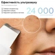 Ультразвуковой аккумуляторный скрабер RZTK ReNova 24000 Type C - изображение 3