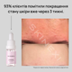 Лосьйон для проблемної шкіри від комедонів та чорних цяток Skinexi Soft Daily Lotion 15 мл - зображення 8