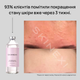 Лосьйон для проблемної шкіри від комедонів та чорних цяток Skinexi Soft Daily Lotion 250 мл - зображення 8
