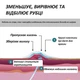 Силиконовый пластырь от шрамов и рубцов молочной железы EpiDerm Areola Circles 8 см - изображение 4