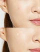 Патчі від акне протизапальні CosRx Acne Pimple Master Patch 24 патчі - зображення 4