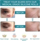 Силиконовый пластырь от рубцов и шрамов Silicone Scar Sheets - изображение 12