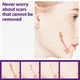 Пластир силіконовий від шрамів та рубців EELHOE Silicone Scar Sheets, гель-пластир від шрамів, тілесний, 4х7,5 см, 4 шт - изображение 4