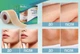Силиконовый пластырь от шрамов и рубцов BoySea Professional Silicone Scar Sheets (4х380 см) - изображение 4