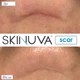 Крем від шрамів з факторами росту Skinuva Next Generation Scar Cream 30 мл - зображення 7