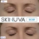 Крем від шрамів з факторами росту Skinuva Next Generation Scar Cream 30 мл - зображення 8