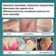 Силіконовий пластир від шрамів та рубців Epi-Derm C-Strip (3,6 х 15 см) 1 шт - зображення 13