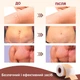 Силиконовый пластырь от шрамов и рубцов RWWXII Silicone Scar Tape (4х300 см) - изображение 5