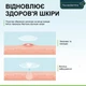 Патчі від прищів та акне Nuvadermis Acne Pimple Patches (120 шт) - зображення 4