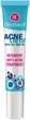 Крем для лица Dermacol AcneClear Intensive Anti-Acne Treatment интенсивный для проблемной кожи 50 мл (8590031104850) - изображение 3