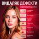 Электрокоагулятор плазменный для удаления папиллом/бородавок Brillix Point Mole Grey - изображение 2