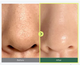 Гідрофільна олія для глибокого очищення пор Anua Heartleaf Pore Control Cleansing Oil тревел 20ml - зображення 3