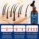 Масло для роста и укрепления волос Hair Growth Oil 3-in-1 Castor Oil + Biotin + Minoxidil 5% Sefudun , 60 ml - изображение 6