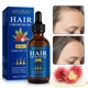 Масло для роста и укрепления волос Hair Growth Oil 3-in-1 Castor Oil + Biotin + Minoxidil 5% Sefudun , 60 ml - изображение 7
