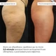 Набір антицелюлітних розігрівальних обгортань Hillary Heating Anti-Cellulite Wrap Set K-11-672 - зображення 6