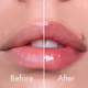 Плампер для губ VT Cosmetics Reedle Shot Lip Plumper Expert інтенсивний з мікроголками, 4.3 г - зображення 3