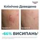 Сыворотка тройного действия Eucerin DermoPure для проблемной кожи 40 мл (4005800294327/4005800367076) - изображение 10