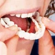Съемные универсальные накладные виниры для зубов InstantSmile - изображение 3