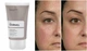 Суспензия из азелаиновой кислоты The Ordinary Azelaic Acid Suspension 10% 30 мл - изображение 2