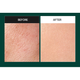 Сыворотка Medi Peel Phyto Cica Nol B5 3000 Shot с микроиглами и центеллой 50 мл - изображение 2