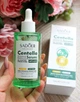 Сыворотка для лица Sadoer Centella Serum Anti-Acne с экстрактом азиатской центели - изображение 2