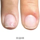 Регенеруюча олія NAILSOFTHEDAY Onistop проти оніхолізису 8 мл - изображение 4