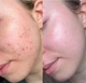 Тонер пэды для лица Dr. Althea 2% Salicylic Acid Clear Pad, 60шт - изображение 4