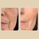Набор средств с лифтинг-эффектом Medi Peel Bor-Tox 5 Peptide Multi Care Kit - изображение 2