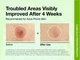 Успокаивающие тонер-пэды с азелаиновой кислотой Anua Azelaic 10 Hyaluron Redness Soothing Pad 90 шт - изображение 5