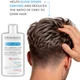 Шампунь Dermedic Capilarte Anti-Aging Антивозрастной 300 мл (5901643177454) - изображение 2